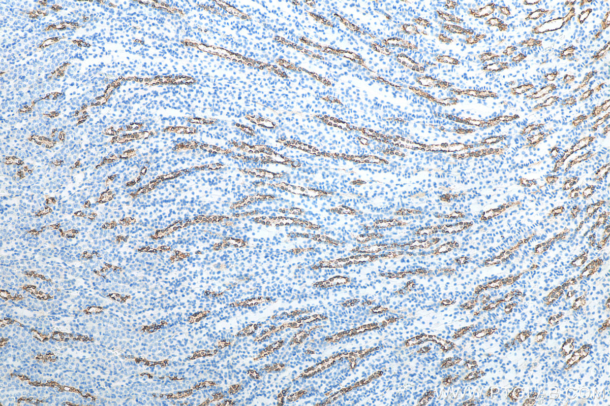 IHC staining of mouse kidney using 29386-1-AP