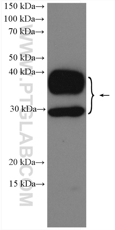 WB analysis of mouse kidney using 29386-1-AP