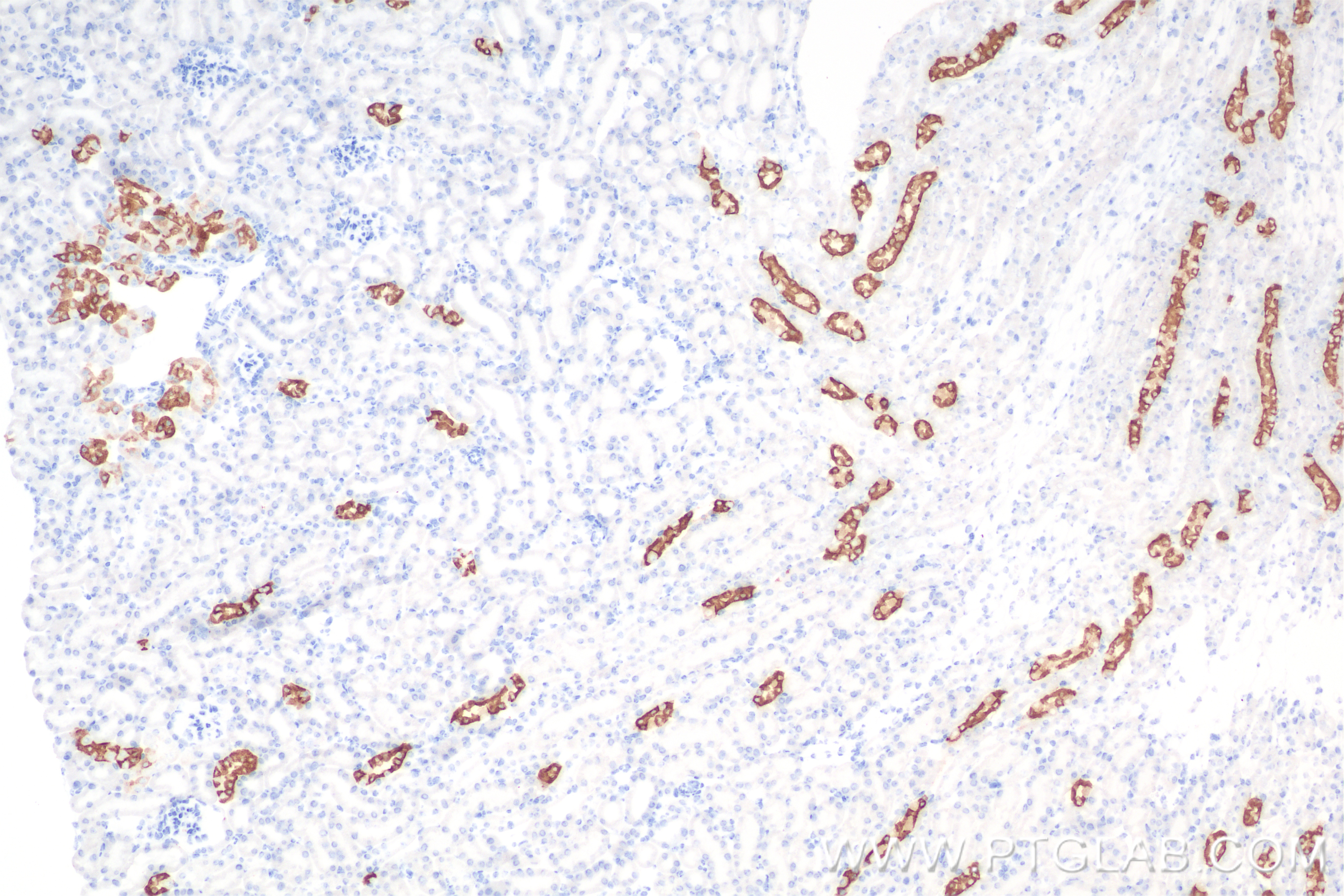 IHC staining of mouse kidney using 85402-1-RR (same clone as 85402-1-PBS)