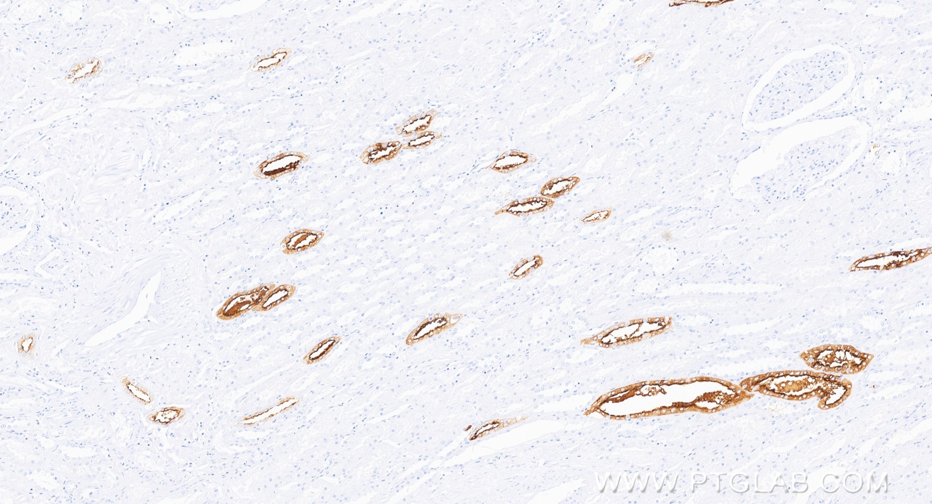 IHC staining of human kidney using 85402-1-RR (same clone as 85402-1-PBS)