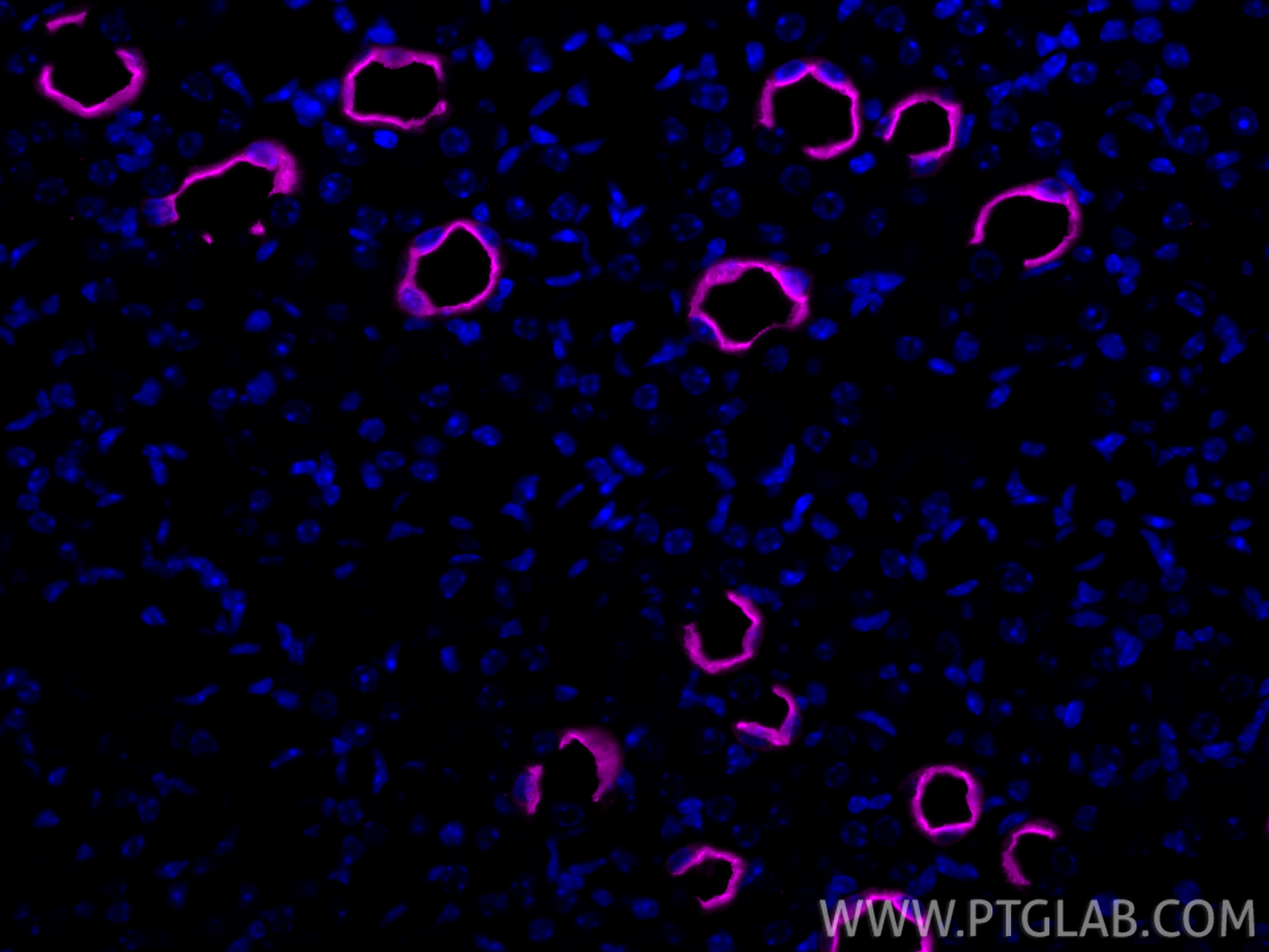 IF Staining of mouse kidney using CL647-85402
