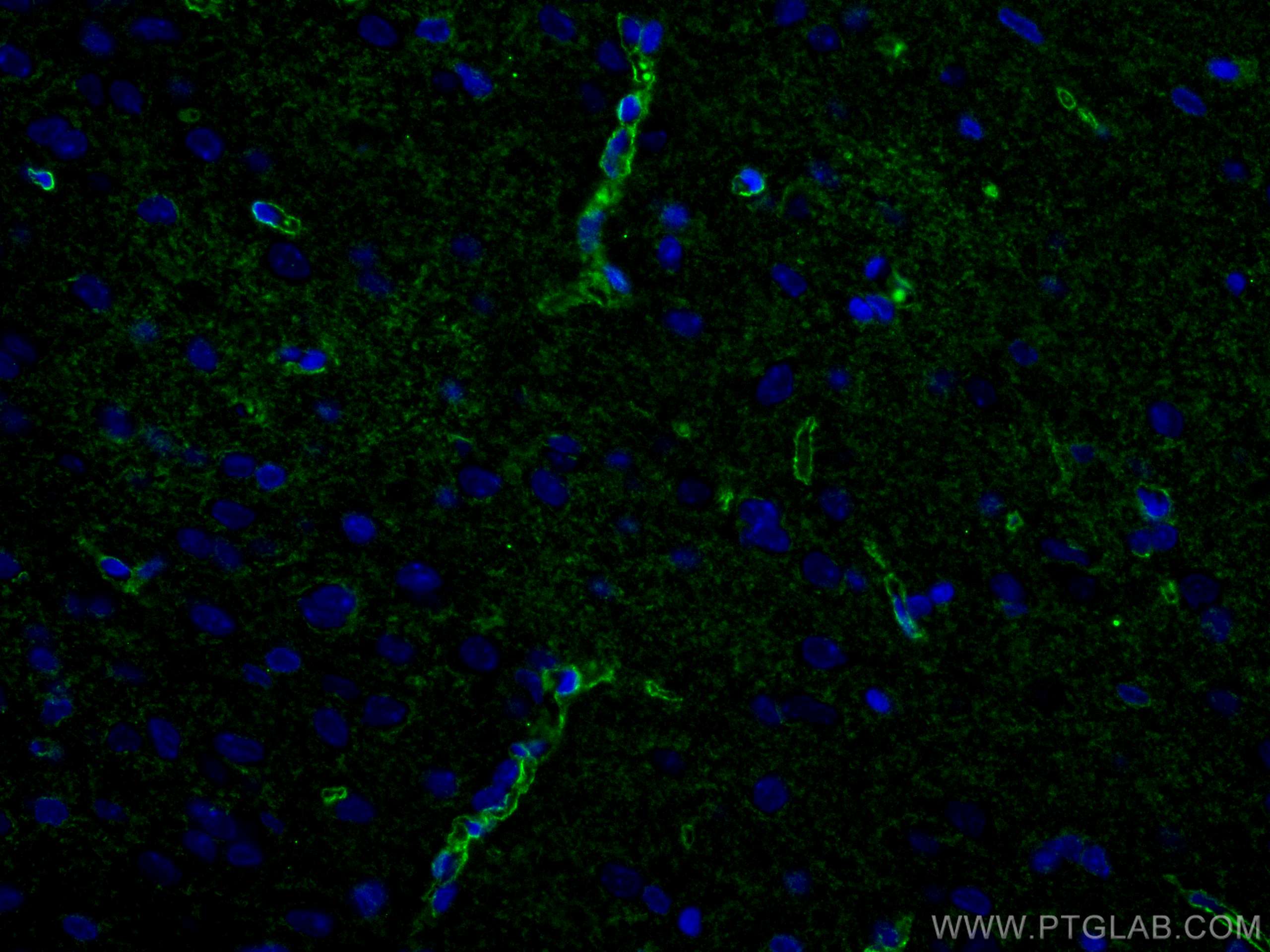 IF Staining of rat brain using 16473-1-AP