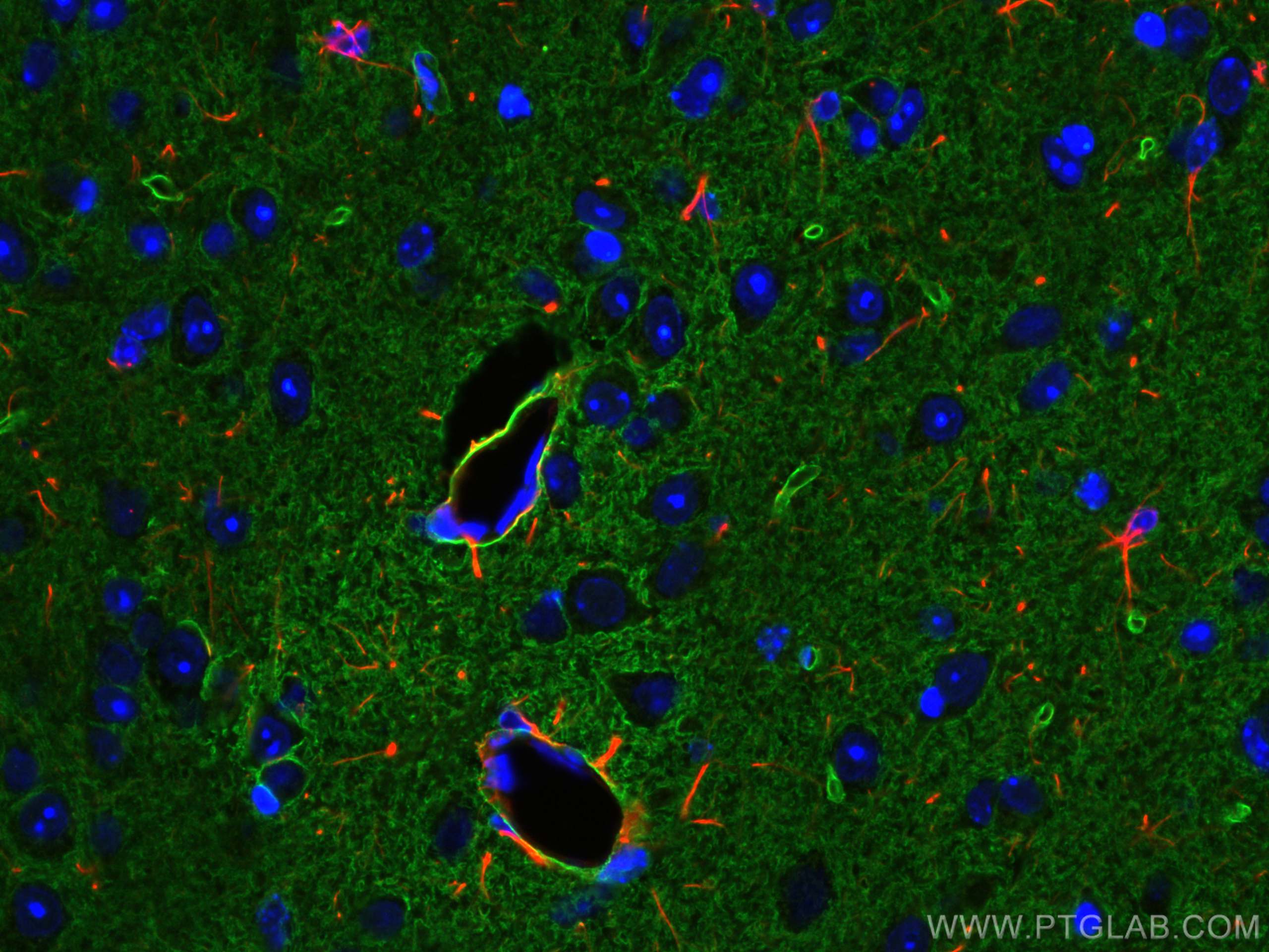IF Staining of mouse brain using 16473-1-AP