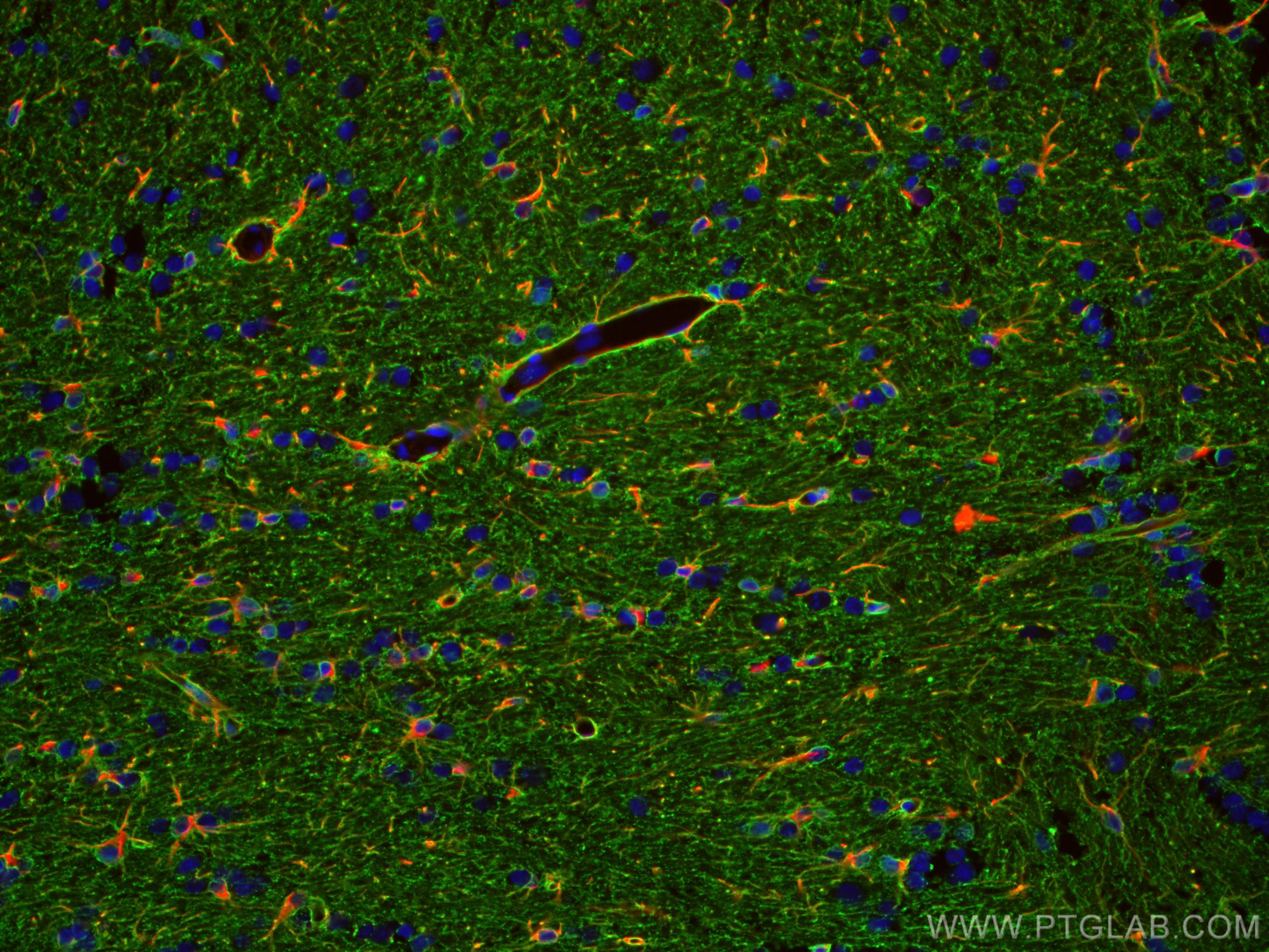 IF Staining of rat brain using 16473-1-AP