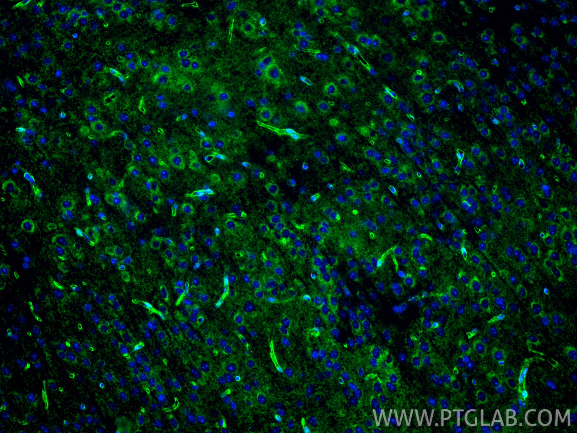 Immunofluorescent analysis of (4% PFA) fixed frozen OCT-embedded mouse brain tissue using Aquaporin 4 antibody (16473-1-AP) at dilution of 1:200 and CoraLite®488-Conjugated Goat Anti-Rabbit IgG(H+L) (<a class='green' href='/productredirect?CatalogNo=SA00013-2' target='_blank'>SA00013-2</a>). IF Staining of mouse brain using 16473-1-AP