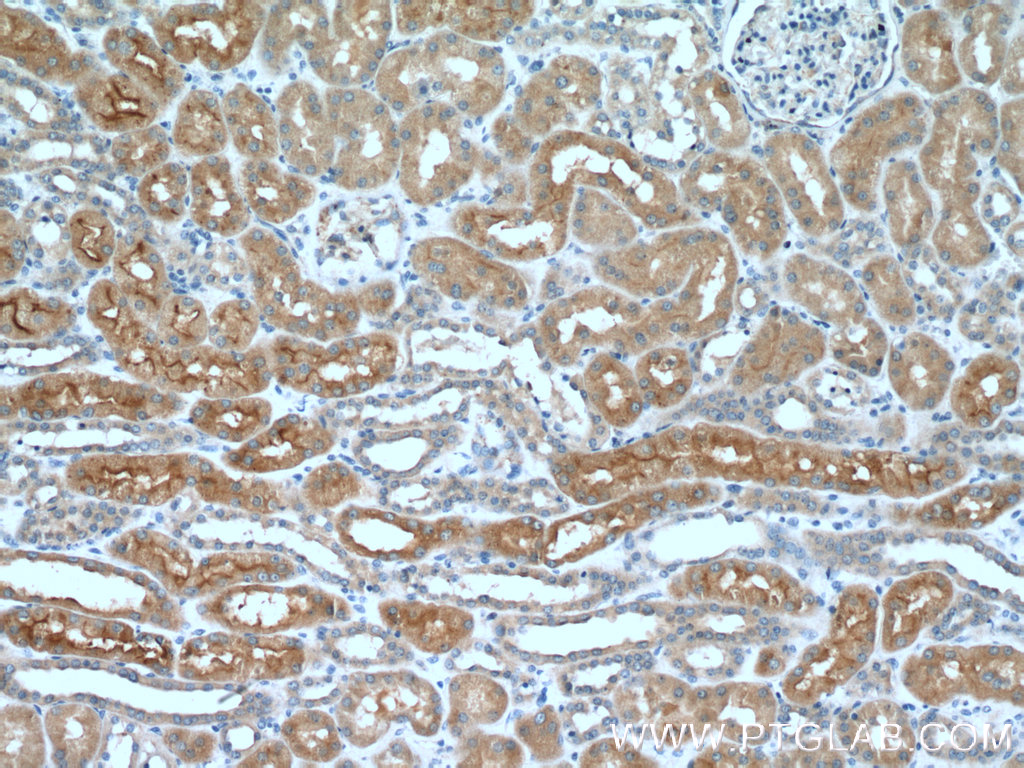 IHC staining of human kidney using 25131-1-AP