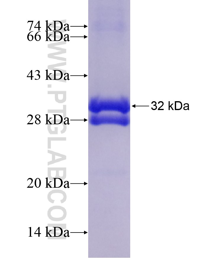 AQP7 fusion protein Ag17945 SDS-PAGE