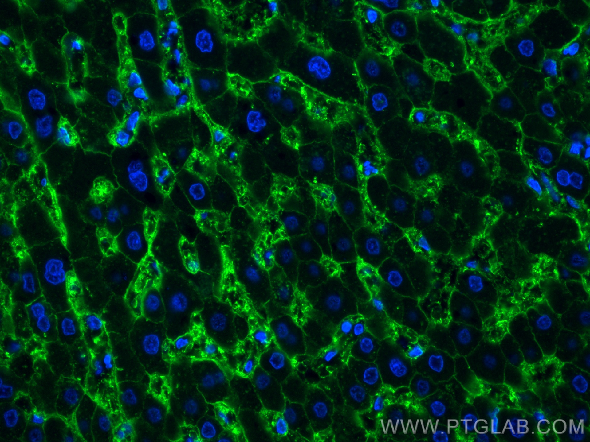 IF Staining of human liver using 20380-1-AP