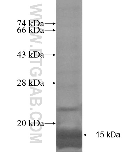 AQP9 fusion protein Ag14379 SDS-PAGE AQP9 fusion protein Ag14379 SDS-PAGE