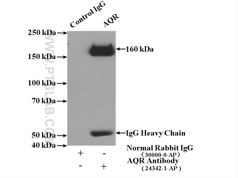 IP experiment of HEK-293 using 24342-1-AP