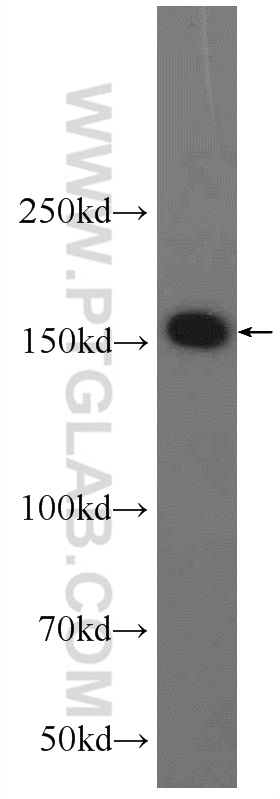 WB analysis of HEK-293 using 24342-1-AP