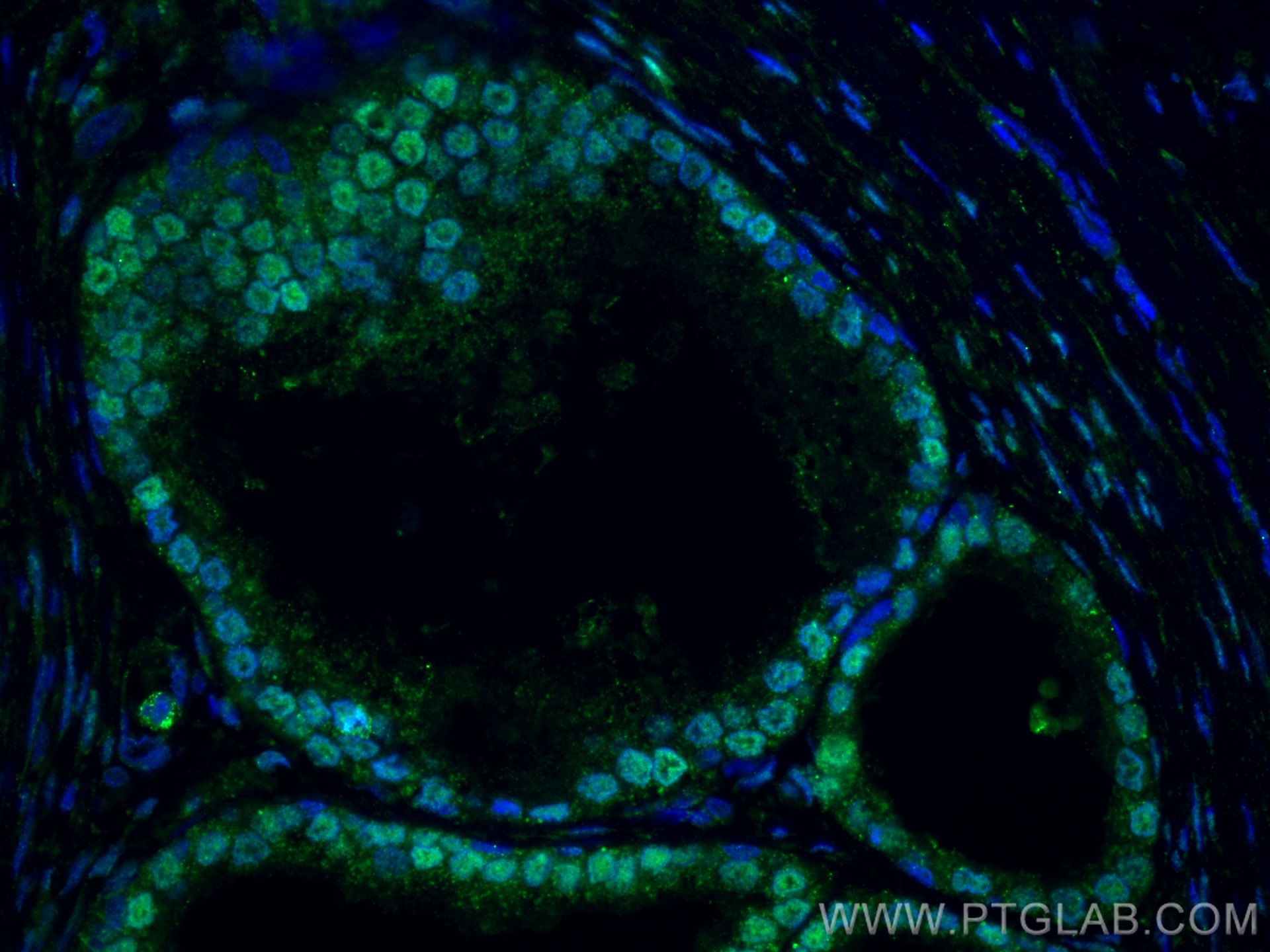 androgen receptor