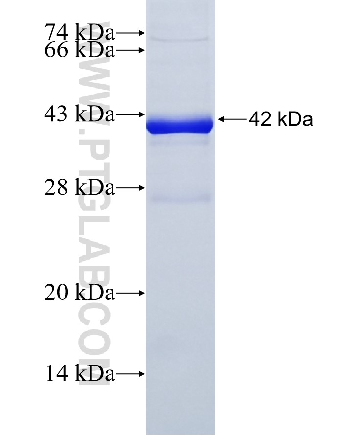 AR fusion protein Ag17291 SDS-PAGE