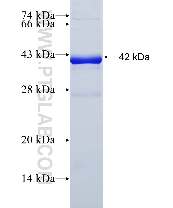 AR fusion protein Ag17291 SDS-PAGE