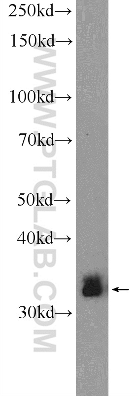 WB analysis of HeLa using 22129-1-AP