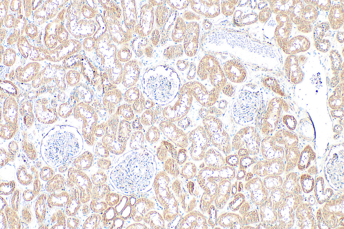 IHC staining of human kidney using 17541-1-AP