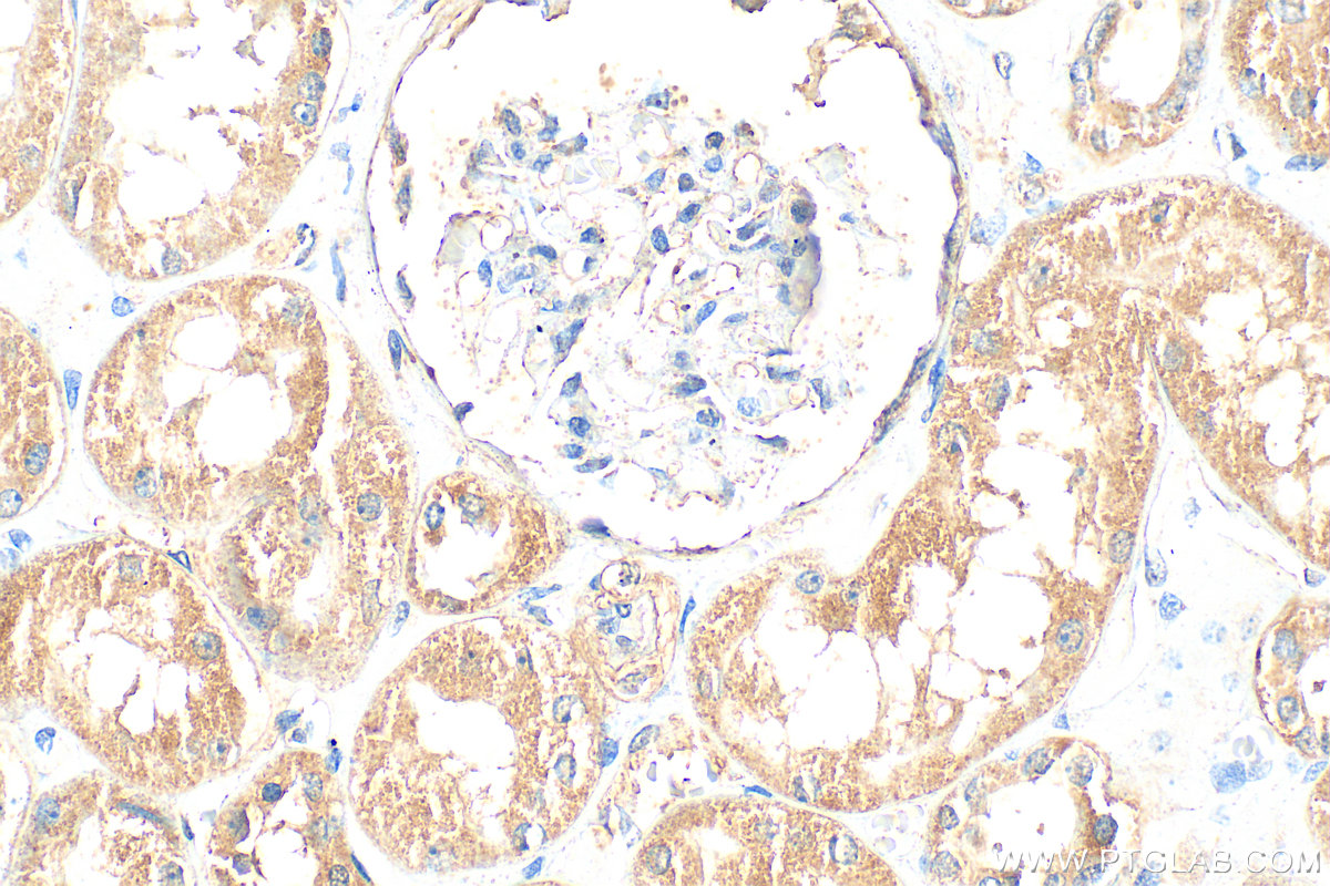 IHC staining of human kidney using 17541-1-AP