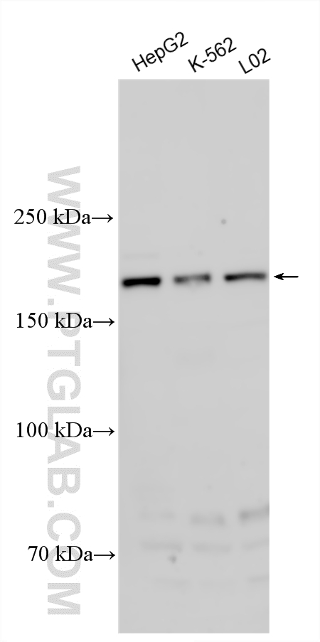 WB analysis using 17541-1-AP