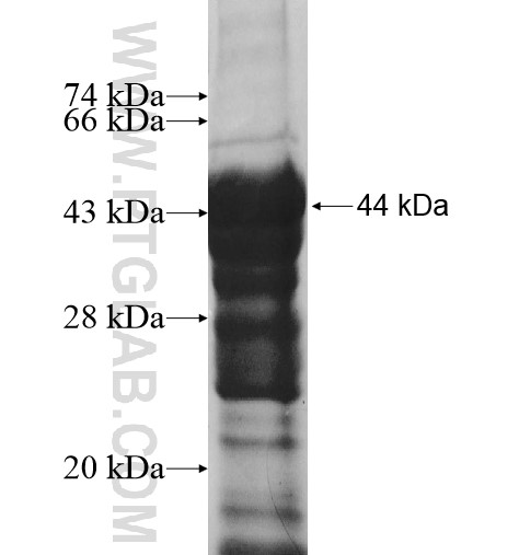 ARAP1 fusion protein Ag11623 SDS-PAGE