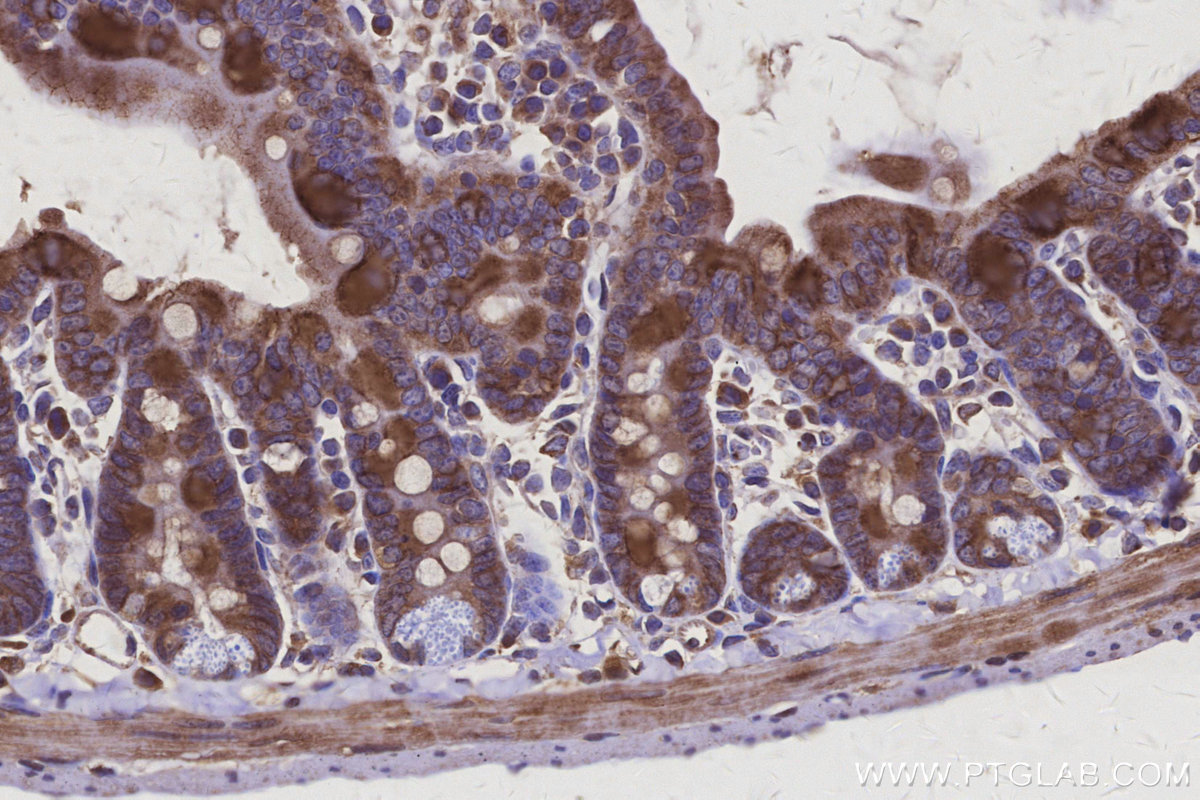 IHC staining of mouse small intestine using 25143-1-AP
