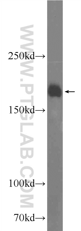 WB analysis of mouse brain using 25143-1-AP