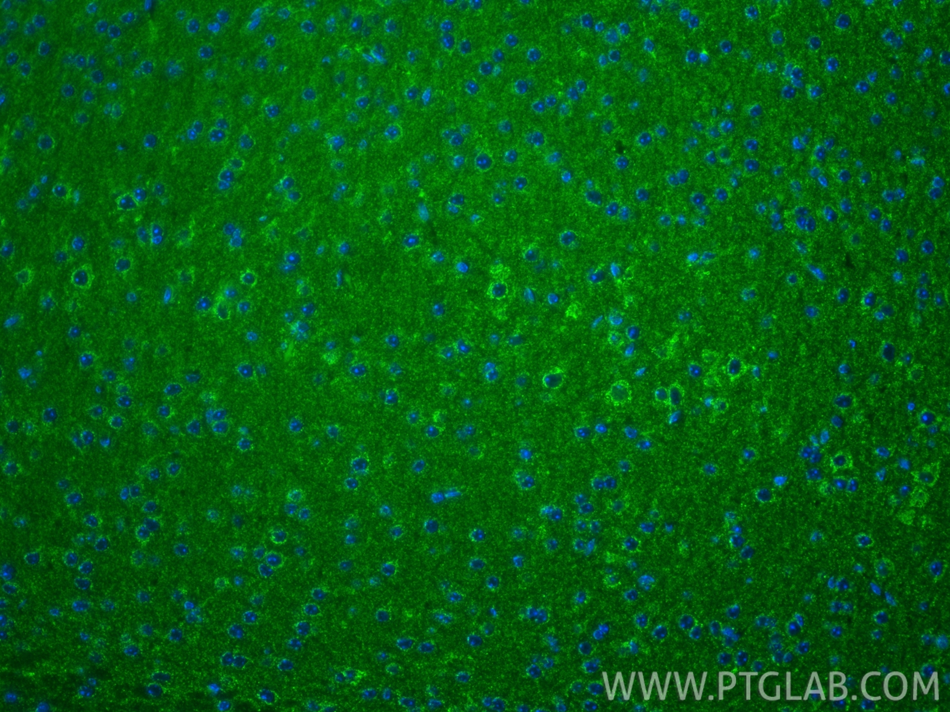 IF Staining of mouse brain using 66550-1-Ig