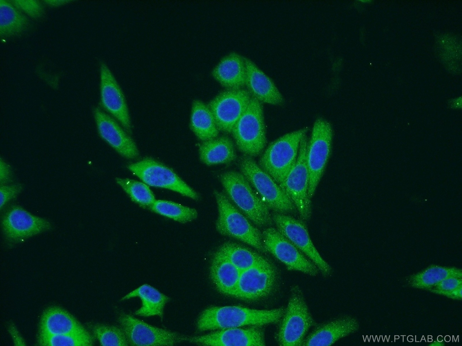 ARCN1