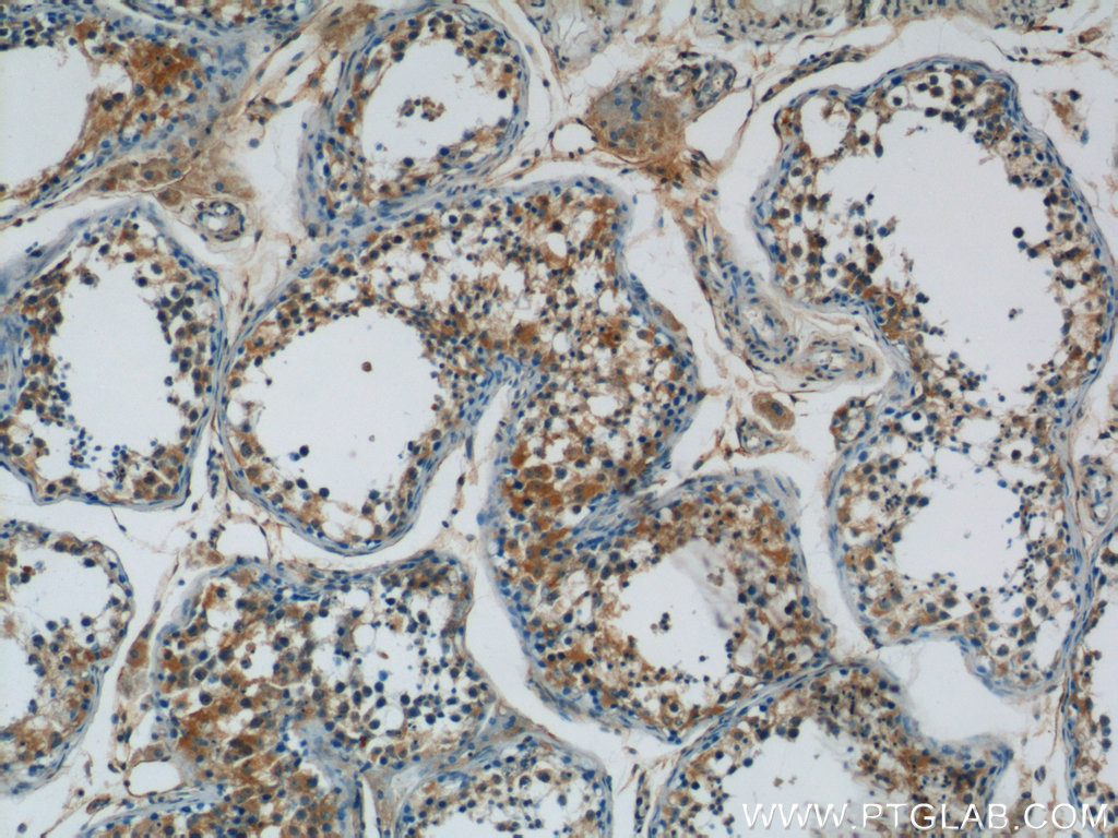 IHC staining of human testis using 23843-1-AP