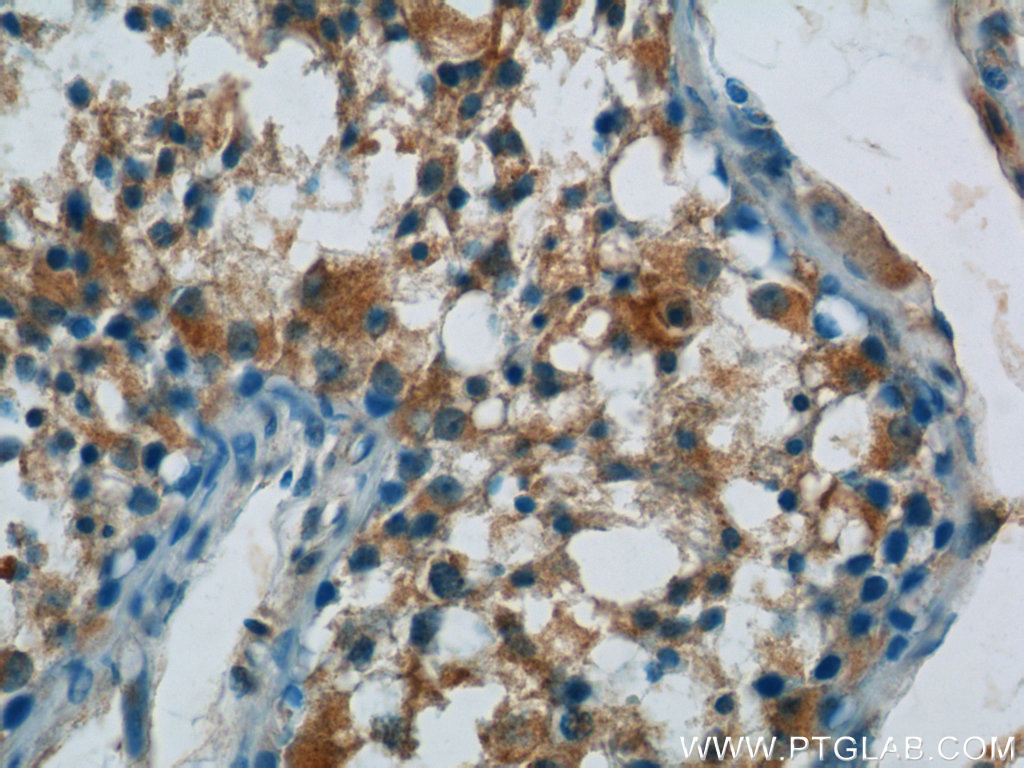 IHC staining of human testis using 23843-1-AP