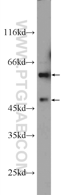 ARCN1