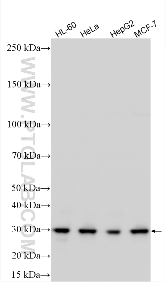 WB analysis using 14803-1-AP WB analysis using 14803-1-AP