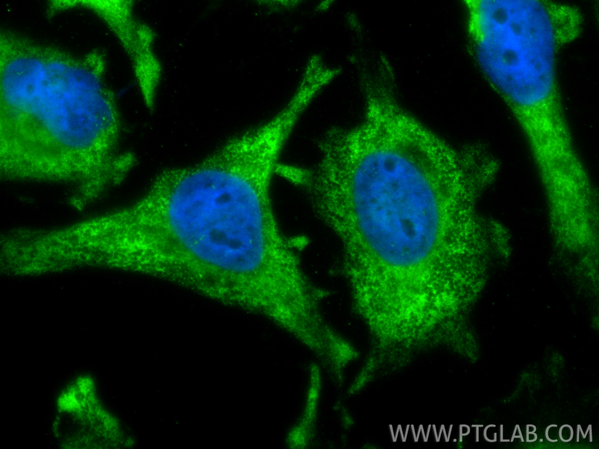 IF Staining of HeLa using CL488-86450-3