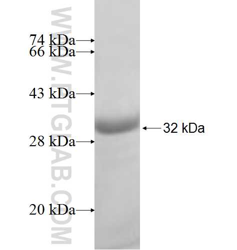 ARD1A fusion protein Ag7406 SDS-PAGE ARD1A fusion protein Ag7406 SDS-PAGE