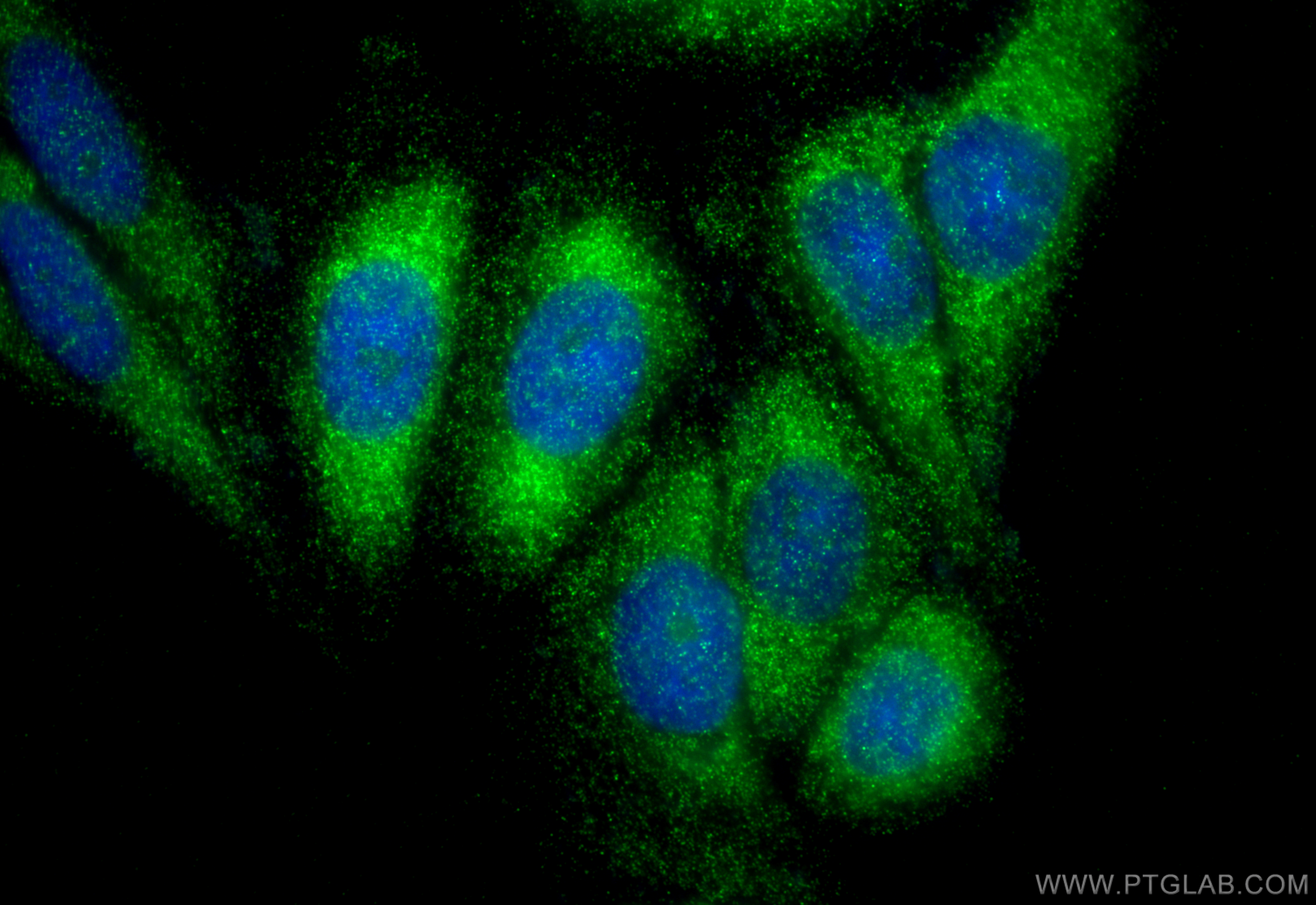 IF Staining of HepG2 using 16036-1-AP
