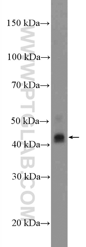 WB analysis of MCF-7 using 16036-1-AP