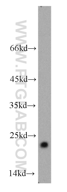 ARF1 Polyclonal antibody