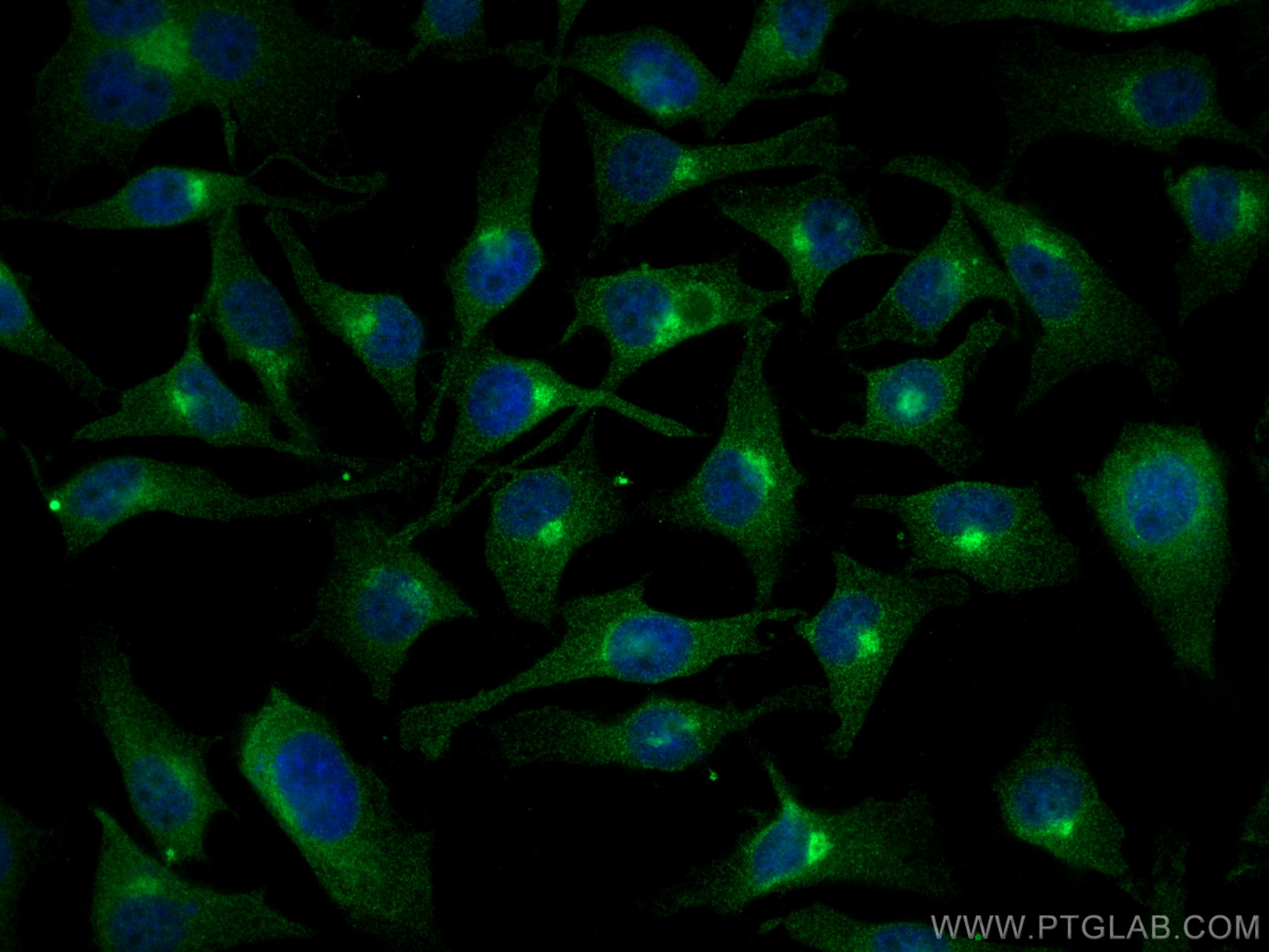 IF Staining of HeLa using 68069-1-Ig (same clone as 68069-1-PBS)