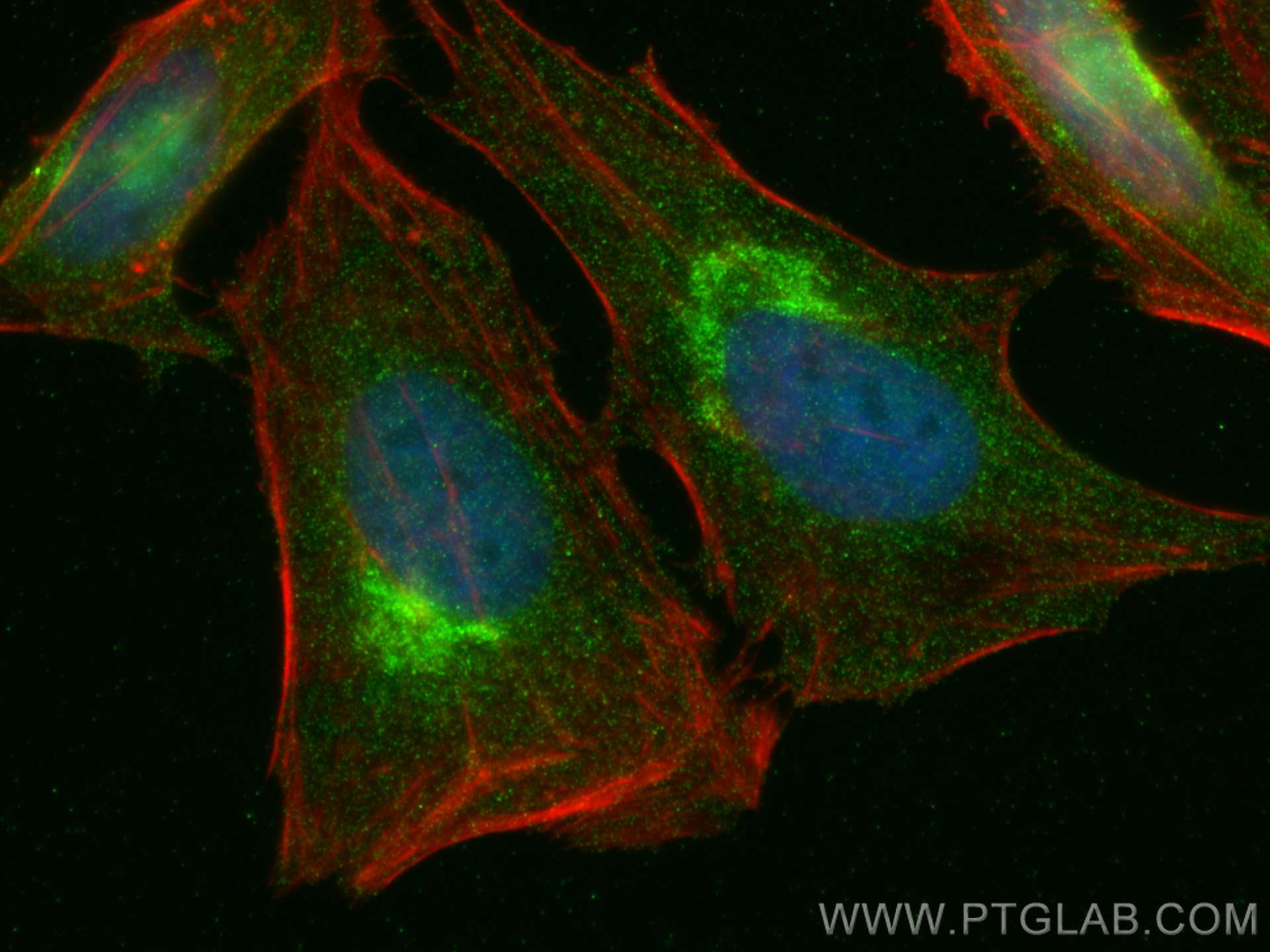 IF Staining of HeLa using 68069-1-Ig (same clone as 68069-1-PBS)