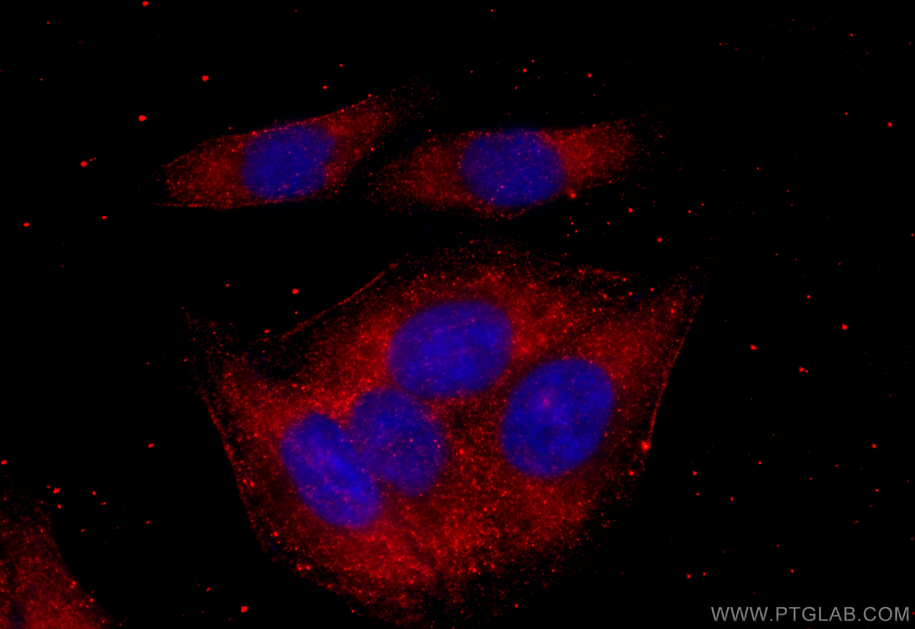IF Staining of HepG2 using 10800-1-AP