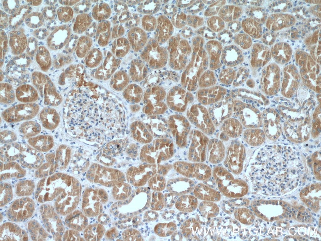 IHC staining of human kidney using 10800-1-AP