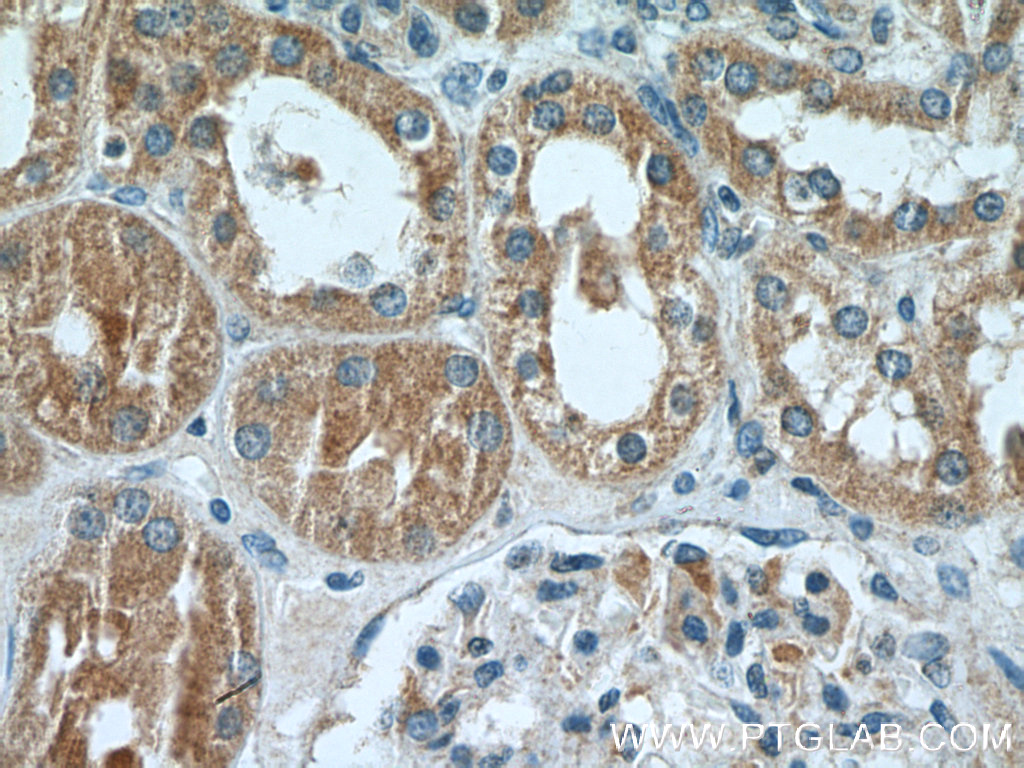 IHC staining of human kidney using 10800-1-AP