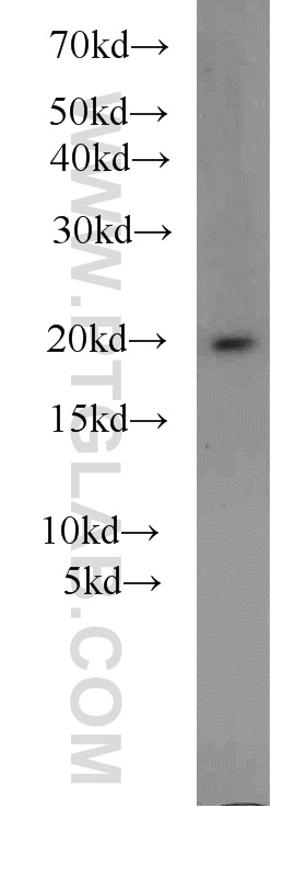 WB analysis of mouse brain using 10800-1-AP