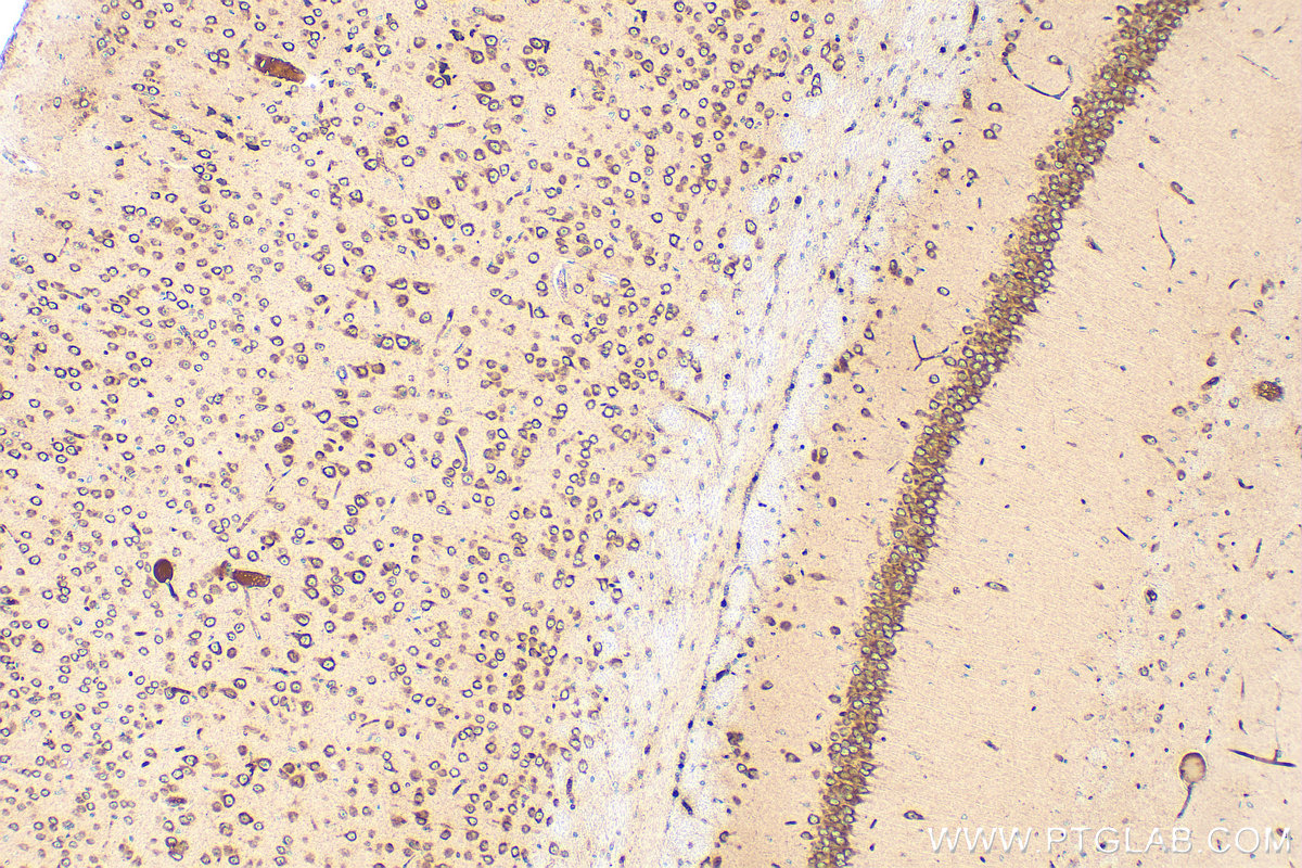 Immunohistochemical analysis of paraffin-embedded mouse brain tissue slide using 22289-1-AP (ARF3 antibody) at dilution of 1:200 (under 10x lens). Heat mediated antigen retrieval with Tris-EDTA buffer (pH 9.0). IHC staining of mouse brain using 22289-1-AP