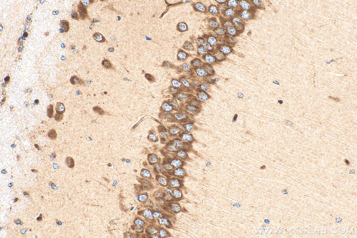 Immunohistochemical analysis of paraffin-embedded mouse brain tissue slide using 22289-1-AP (ARF3 antibody) at dilution of 1:200 (under 40x lens). Heat mediated antigen retrieval with Tris-EDTA buffer (pH 9.0). IHC staining of mouse brain using 22289-1-AP
