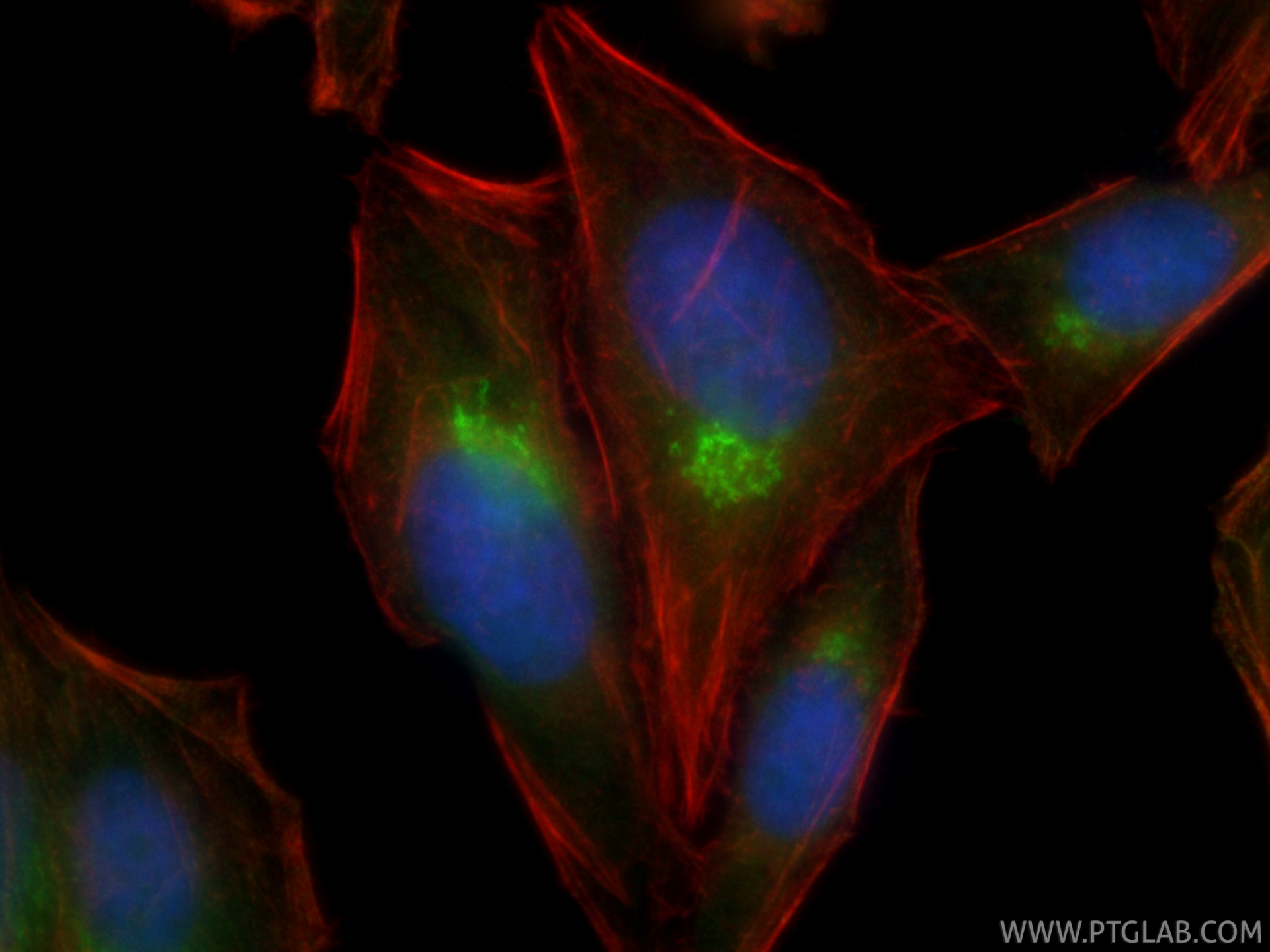IF Staining of HepG2 using 11673-1-AP IF Staining of HepG2 using 11673-1-AP