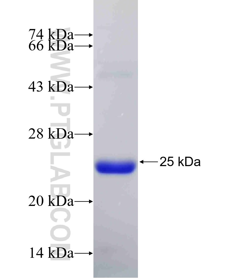 ARF4 fusion protein Ag32663 SDS-PAGE ARF4 fusion protein Ag32663 SDS-PAGE