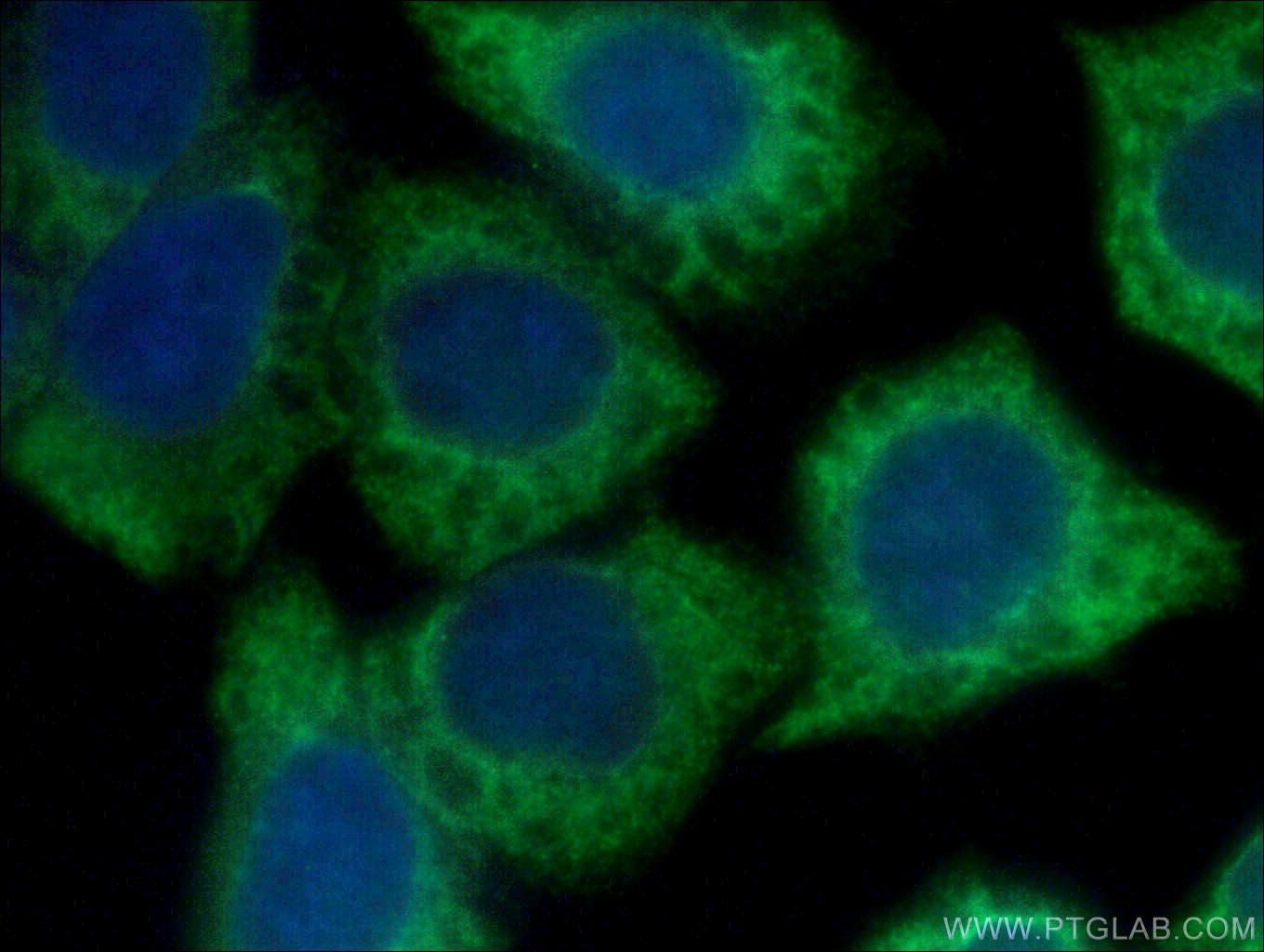 IF Staining of HeLa using 20227-1-AP