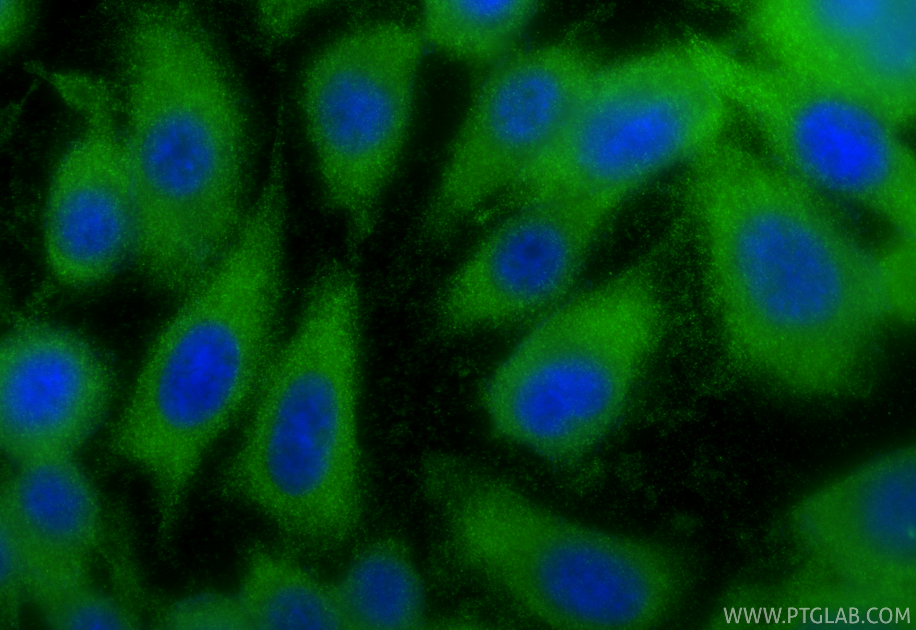 Immunofluorescent analysis of (-20°C Ethanol) fixed PC-3 cells using ARF6-Specific antibody (20225-1-AP) at dilution of 1:400 and CoraLite®488-Conjugated Goat Anti-Rabbit IgG(H+L) (<a class='green' href='/productredirect?CatalogNo=SA00013-2' target='_blank'>SA00013-2</a>). IF Staining of PC-3 using 20225-1-AP