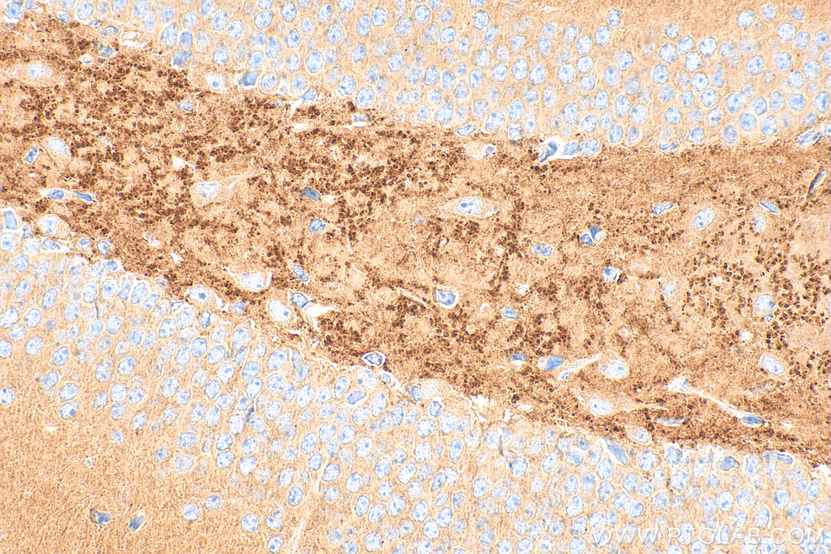 IHC staining of mouse brain using 13571-1-AP