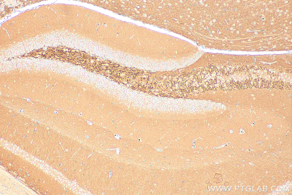 IHC staining of mouse brain using 13571-1-AP